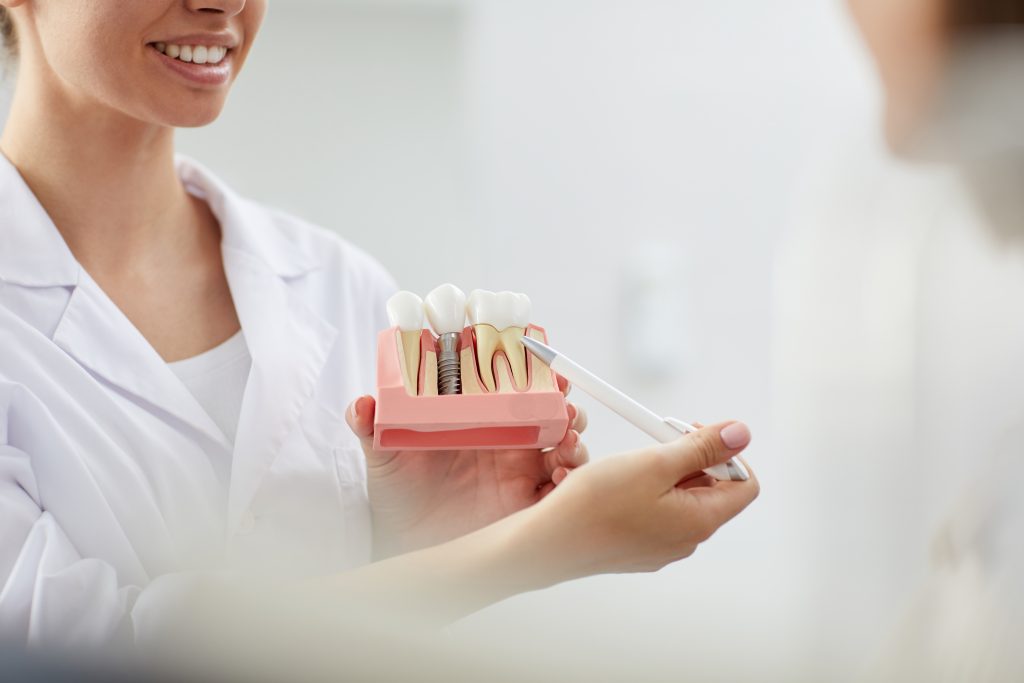 Odontóloga explicando un tratamiento con un modelo dental